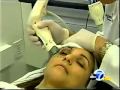 Doctor's P.R. - Eyes by Thermage Eyelid Rejuvenation on TV