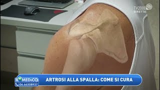 Artrosi alla spalla: come si cura