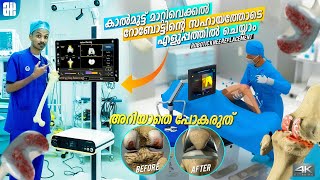 Robotic Knee Replacement Surgery ചെയുന്നതെങ്ങനെ..? | കാൽമുട്ട് മാറ്റിവെക്കൽ പുതിയ രീതി |Full Details