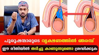 പുരുഷന്മാരുടെ വൃക്ഷണത്തിൽ ഞരമ്പ് ഈ രീതിയിൽ തടിച്ചു കാണുന്നുണ്ടോ ശ്രദ്ധിക്കുക /Baiju's Vlogs