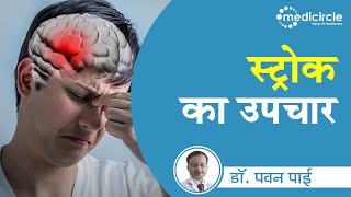 Brain Stroke ka ilaj - Golden Period in Stroke (Hindi) - 3 ways to treat Stroke | Ischemic Stroke