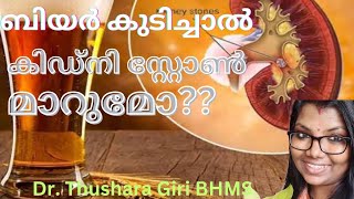 ബിയർ കുടിച്ചാൽ കിഡ്നി സ്റ്റോൺ മാറുമോ??? kidney stone കൂടുതൽ അറിയാം