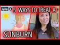 HOW TO TREAT A SUNBURN | WITH DR. SANDRA LEE HOW TO TREAT A SUNBURN | WITH DR. SANDRA LEE