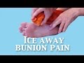 Ice Away Bunion Pain In 3 MINUTES