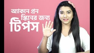 অ্যাকনে প্রন স্কিনের জন্য ৫টি টিপস | 5 Tips for Acne Prone Skin | 2019