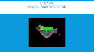 Total Knee Replacement of Severe Varus Deformity Using RoboKnee