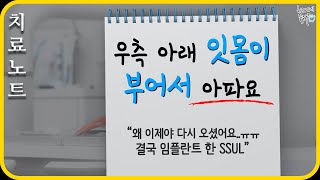 [치료노트#.3]잇몸이 부어서 왔는데 임플란트 하고 간 썰