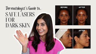 Best Lasers for Melanin-Rich \u0026 Deep Skin Tones | Dermatologist Explains