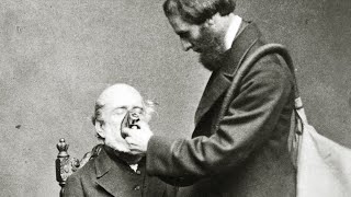 Top 10 Questionable Medical Treatments From The Victorian Era