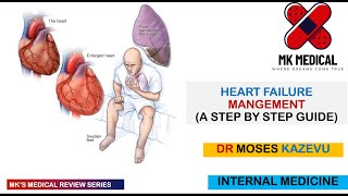 Heart failure (Management)