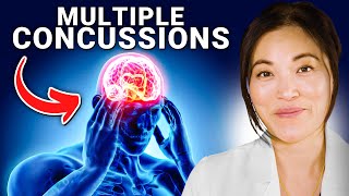 The Truth About Multiple Concussions... Long Term Damage & Recovery