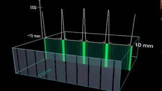 Fraunhofer Diffraction Through Multiple Slits