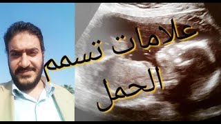 علامات تسمم الحمل وعلاجه وخطورة التأخر في علأجه