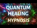 Accessing Higher Wisdom: Quantum Healing Hypnosis Session