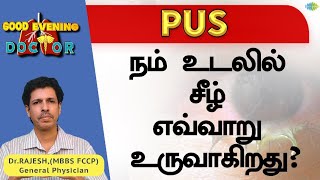 நம் உடலில் சீழ் எவ்வாறு உருவாகிறது? |  EP 165 | Good Evening Doctor