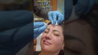 Botox ile zamanda meydan okuyun ve gençliğinizi geri kazanın! #botoks #botoxtreatment