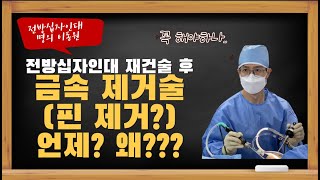 [전방십자인대 재건술 흔한 질문 6] 금속 제거술 (핀제거?) 언제? 왜? 하는 것인가요?