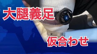 【義足の仮合わせ】大腿義足の調整と歩行訓練