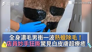 全身濃毛男衝一波熱蠟除毛！店員妙手狂撕驚見白皮膚超療癒