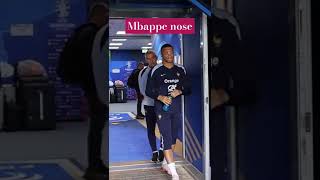 Kylian Mbappe Training after Nose Injury 🔥🔥. #uefaeuro2024 #realmadrid #kylianmbappe