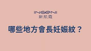 妊娠紋是怎麼產生的？哪些地方需要預防孕期紋路呢？白色妊娠紋有機會改善嗎？｜新肌霓 INGENI