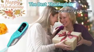 Thanksgiving Special: Excimer Laser 308nm UVB Light Therapy at Home Sale