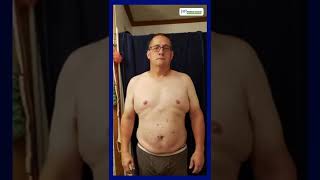 Gastric Sleeve Before and After Success Story Male