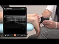 ultrasound of the plantar fascia