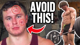 15 Ways to AVOID Acne From Working Out!