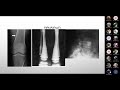 fase 3 clase 03 imagenologÍa osteoarticular