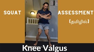 Muscle Imbalance | Valgus Knee | Overhead Squat Assessment
