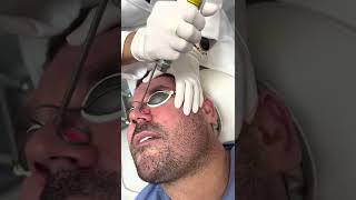 Fractional laser treatment | Newcastle Cosmetic Doctor | Skin laser treatment by laser therapist