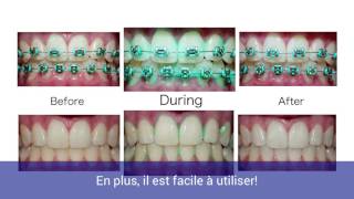 PLAQUE HD - ORAL SCIENCE || FRANÇAIS : Étape par étape