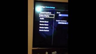X1 dvr issues