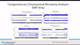 12 Chromosomal microarray testing