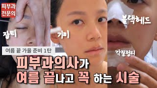 eng. 여름끝 가을준비 시술 1탄🚨 잡티기미 지우고, 햇빛에 탄 피부세포들 살리기 응급시술 추천🚨| 피부과전문의 | 셀프시술