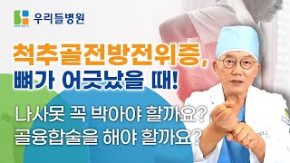 Press CC Eng subtitle) 척추골전방전위증?! 과연, 나사못 박아야 할까요? 골융합술 꼭 해야 할까요? (feat. 이상호 박사)