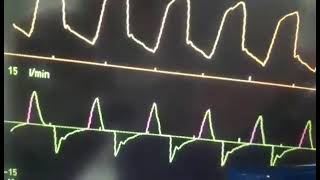 Basic Waveforms