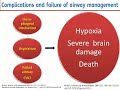 raa online difficult airway