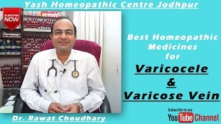 Best Homeopathic Medicines for Varicocele and  Varicose Veins | Varicocele के लिए सबसे अच्छी दवा