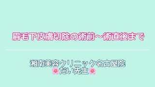 眉下リフト(眉毛下皮膚切除術）の術前〜術直後