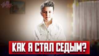 Уже в 11 лет я стал седым! Что произошло?