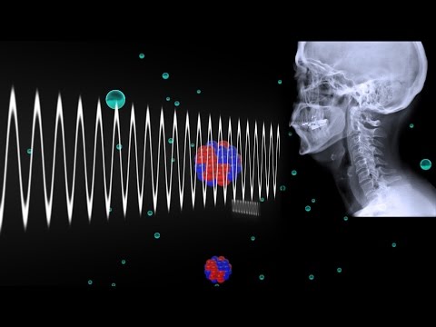 What do black areas on an xray mean?