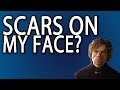 Face Scars: How To Get Rid Of Scar Tissue On Your Face Face Scars: How To Get Rid Of Scar Tissue On Your Face