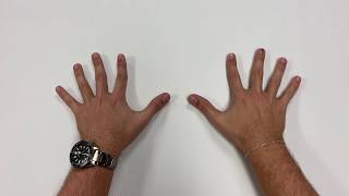 American Stroke Foundation: Finger and Wrist Range of Motion (ROM)