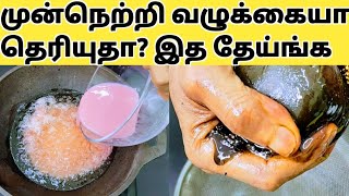 முன்நெற்றி வழுக்கையா? இனி ஒரு முடி கொட்டுனா 100 முடி முளைக்கும் Hair Growth Tips for Forehead Tamil