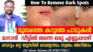 മുഖത്തെ കറുത്ത പാടുകൾ മാറാൻ എളുപ്പവഴി | How to remove dark spots from face Malayalam | Dr Visakh