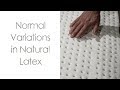 Normal Variations in Natural Latex