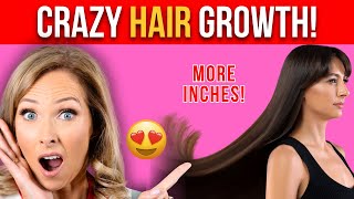 How to Grow Your Hair Faster (3 Tips for Crazy Hair Growth) | Dr. Janine