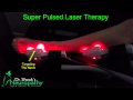 Advanced Peripheral Neuropathy Treatment Hickory NC%2C Dr  Brad Shook%2C Laser Pain Clinic